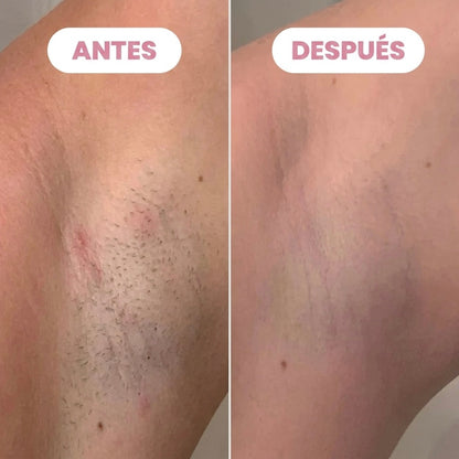 VelvetShave™ — Afeitadora Eléctrica 2 en 1 Para Mujeres