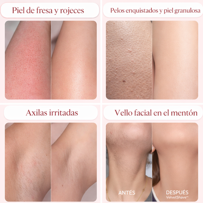 VelvetShave™ — Afeitadora Eléctrica 2 en 1 Para Mujeres